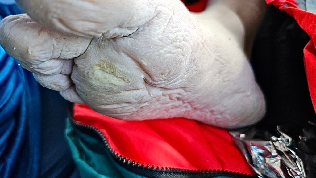 White, wrinkly and overexposed foot belonging to Ross Edgley.